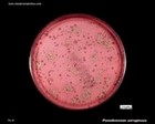 alpha and gamma hemolysis on blood agar